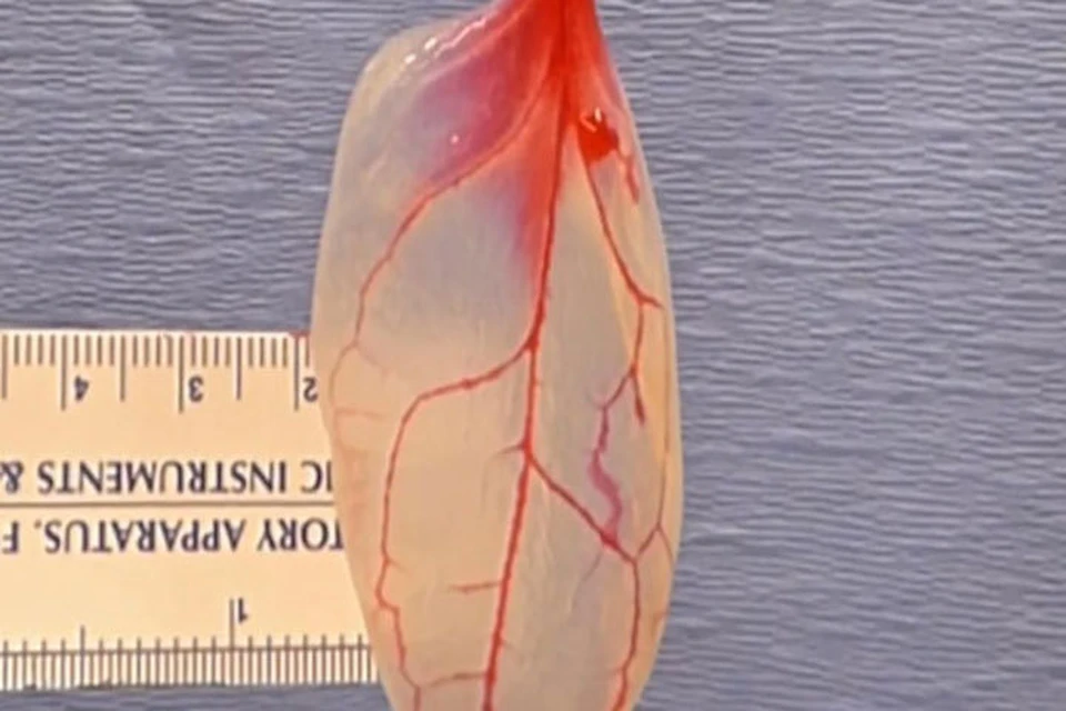Шпинат в качестве заменителя инфицированной ткани сердца в момент исследования . Фото WPI.