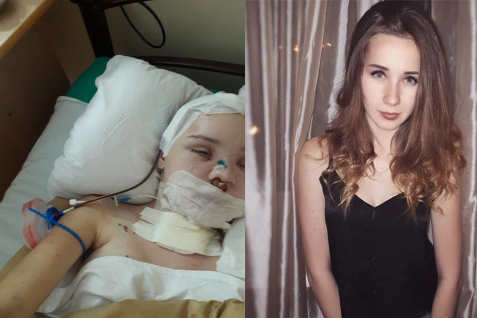 Жизнь Леры разделилась на две части: до и после аварии