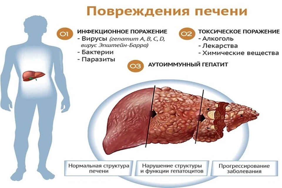 Желчная колика. Причины. Симптомы желчной колики. Диагностика. Лечение