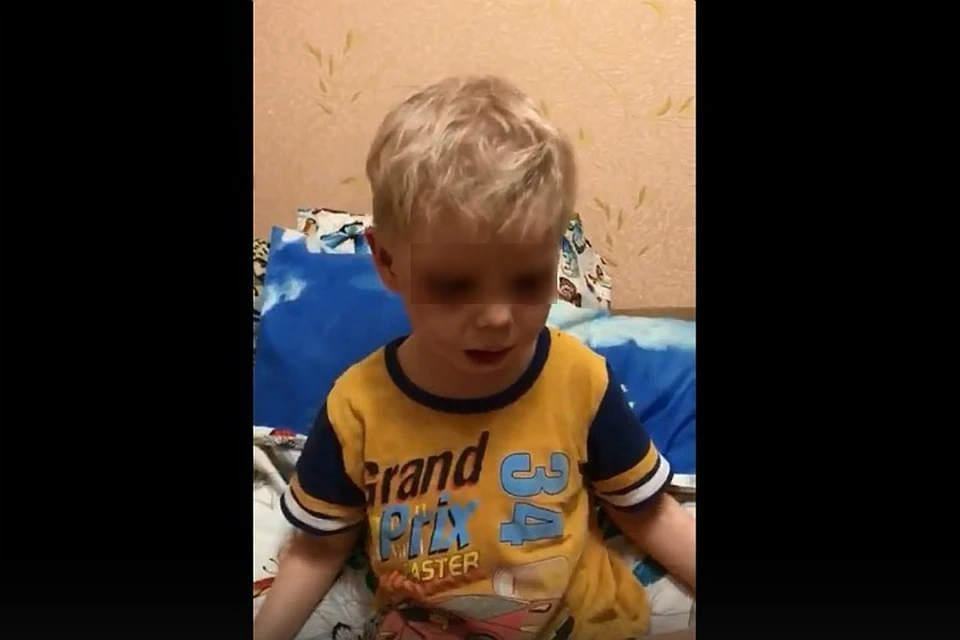 На лице и теле ребенка обнаружили множественные синяки и ссадины.
