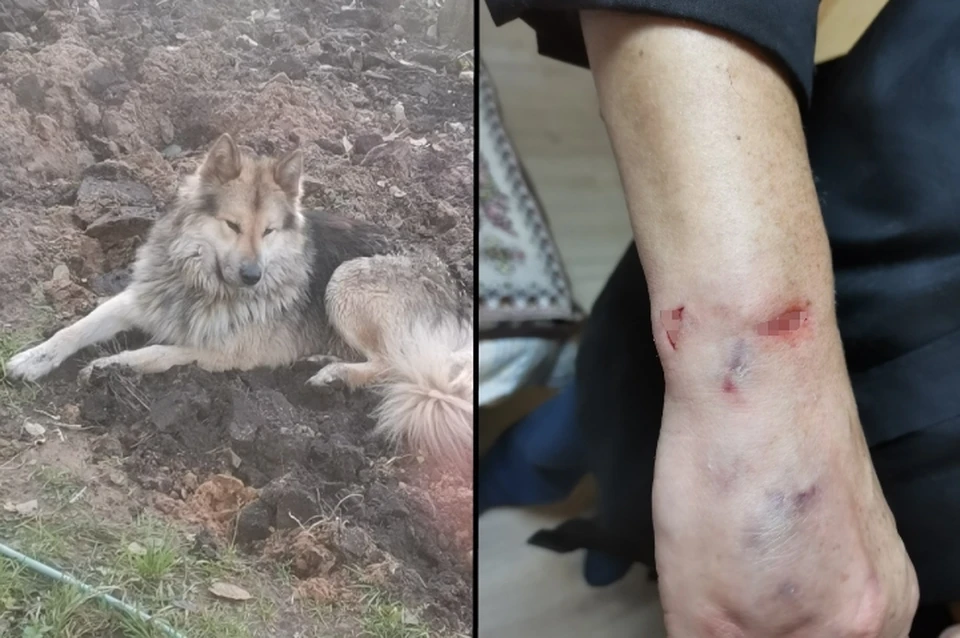 Агрессивный пес прокусил руку жительнице Ленобласти. Фото: vk.com/orekhovo_69