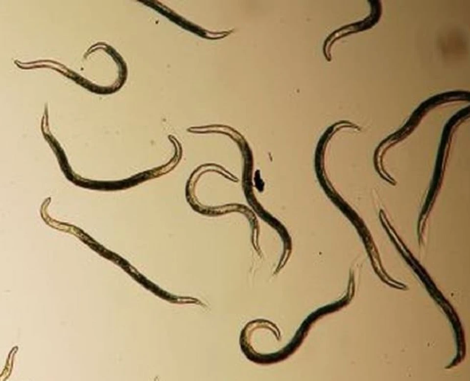 В какой среде обитает червь паразит. Черви-паразиты нематоды.. Круглые черви нематоды паразиты. Круглые гельминты,нематоды. Nematoda (круглые черви).