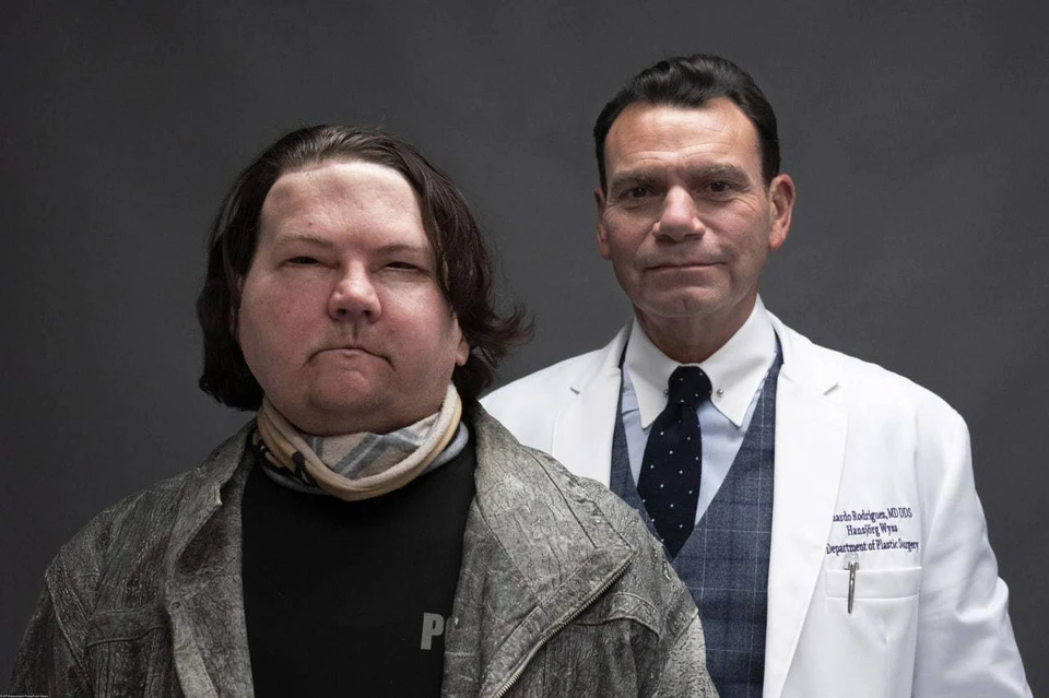 Американские врачи впервые в истории успешно пересадили лицо и руки. Фото: EASTNEWS/AP.