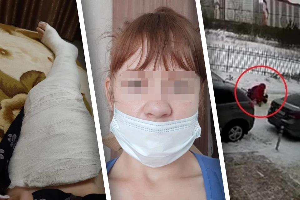 После инцидента женщина лежит дома с загипсованной ногой. Фото: предоставлены героиней публикации / стоп-кадр из видео.