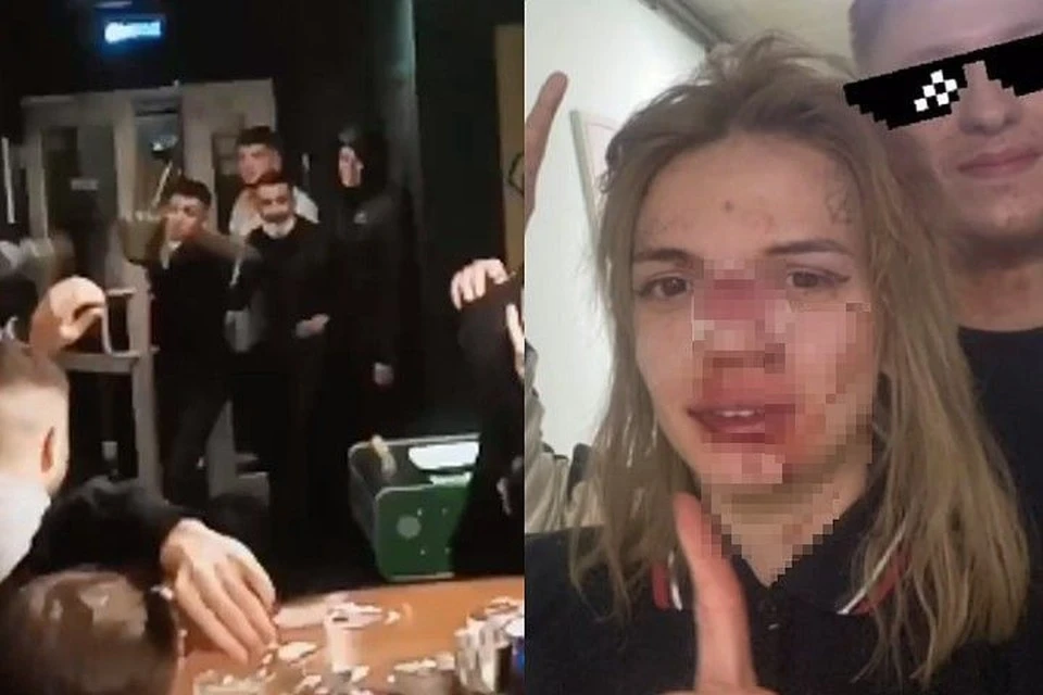В массовой драке пострадали случайные гости бара. Фото: предоставлено героями публикации