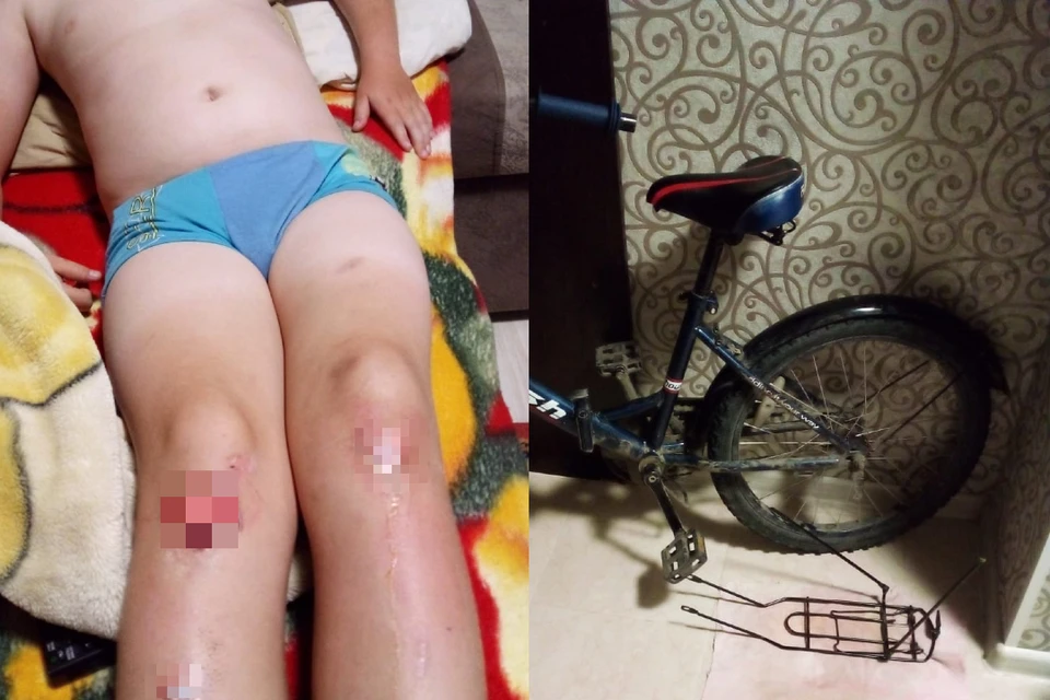 Сперва ребенку сломали велосипед, а потом он пришел домой с разбитыми коленками. Фото: Предоставлено родителями мальчика