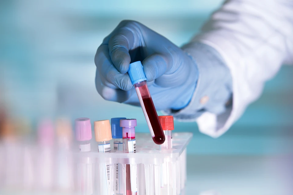 Универсальное требование для подготовки к лабораторным исследованиям - кровь нужно сдавать натощак.