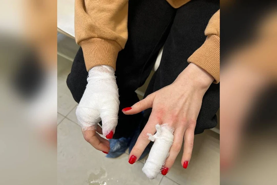 Огромная бездомная собака напала на девушку и ее питомца – шпица Мартина