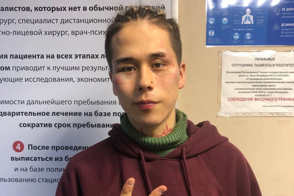 Петербургского блогера выследили и избили за его жесткие розыгрыши. Фото: Кирилл Шучер