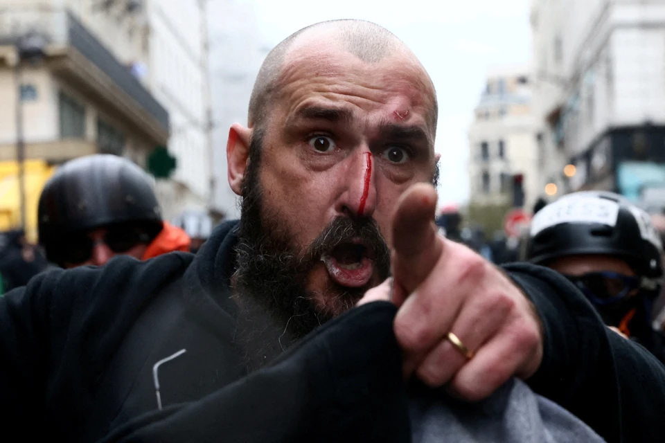 Раненый участник уличного протеста в столице Франции.