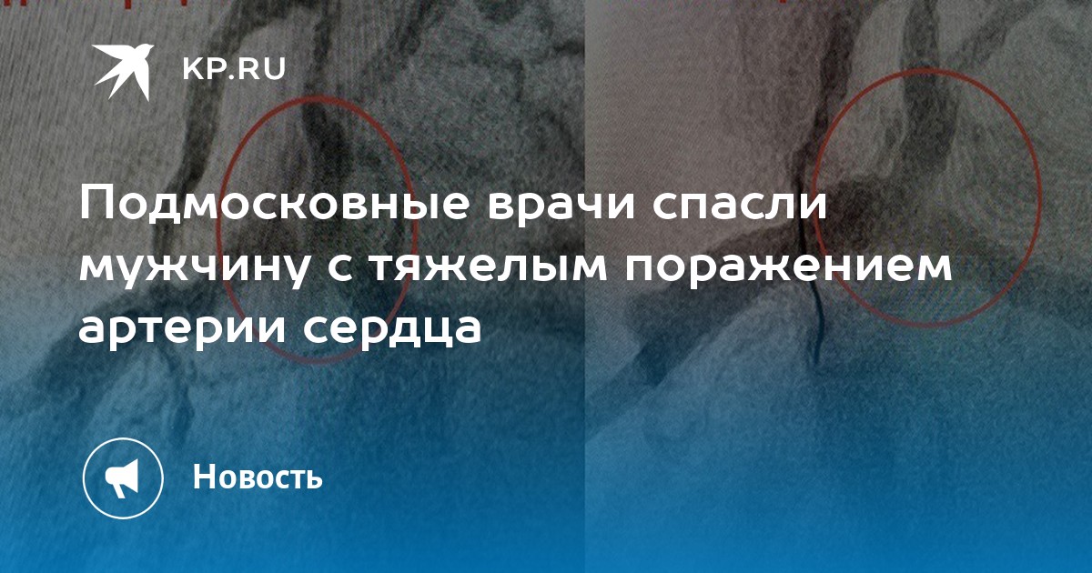 Тяжело на сердце что это. Душа болит а сердце плачет цитаты. Тяжело на душе. Ноющие боли в грудной клетке. Ноющие боли в грудной клетке.