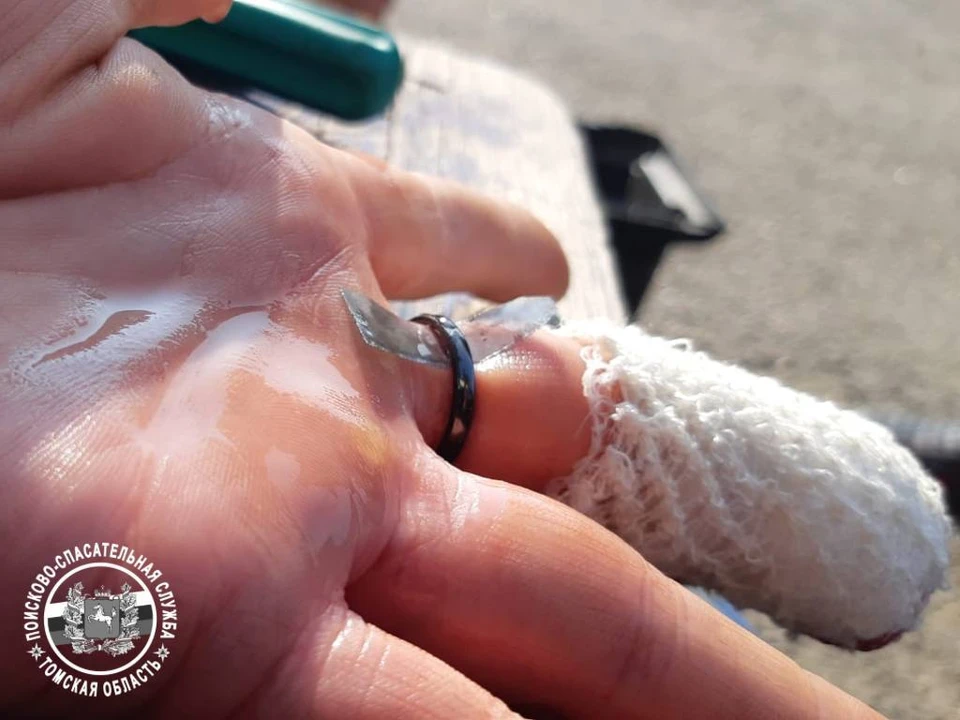 Чтобы снять кольцо с травмированного пальца, девушка обратилась к спасателями. Фото: ОГБУ ТО ПСС