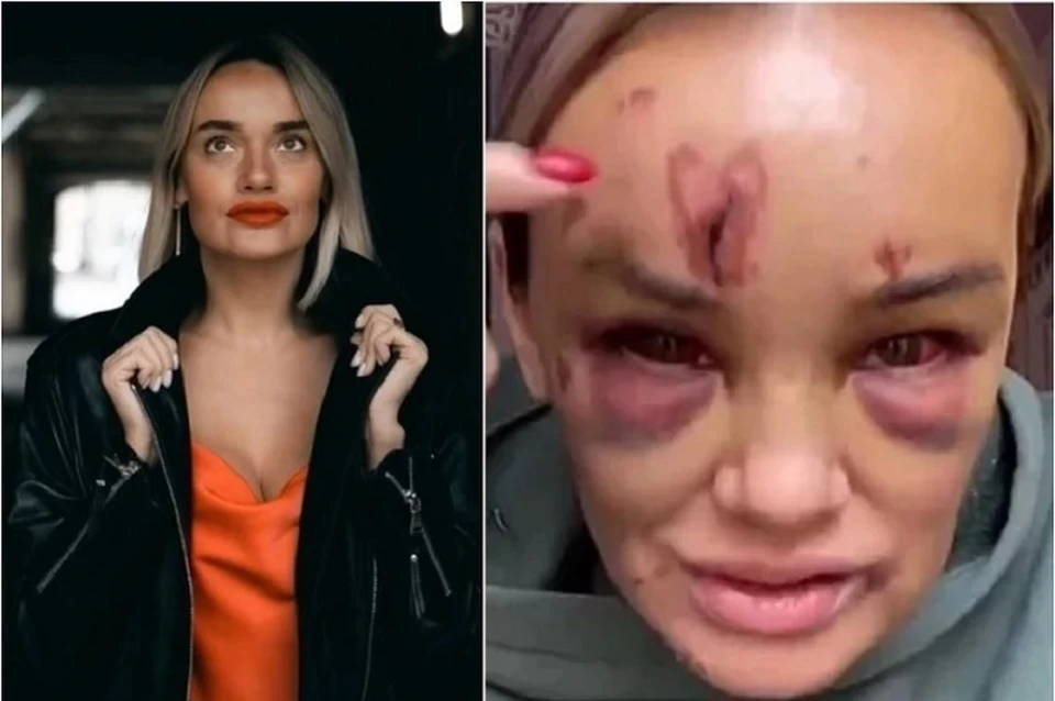 Продюсер Анна Леонова в суде простила мужчину, который жестоко избил ее в Петербурге. Фото: СОЦСЕТИ