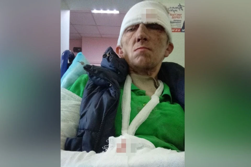 Женщина получила перелом руки и сотрясение. Фото: предоставлено героиней публикации.