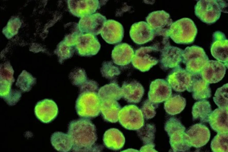 Naegleria fowleri, которую часто называют «амебой, поедающей мозг»