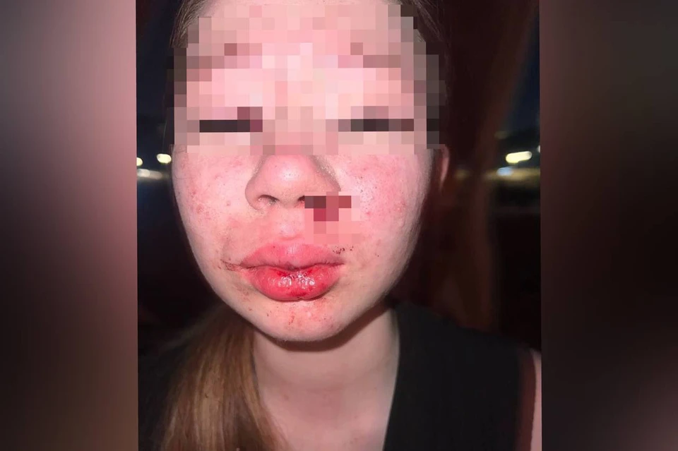 17-летнюю нижегородку изнасиловали на набережной Гребного канала. Фото: предоставлено героем публикации