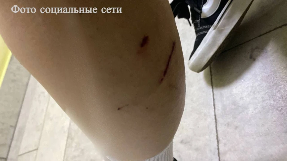 Собаки покусали подростка в Минводах. Фото: социальные сети, предоставлено СК