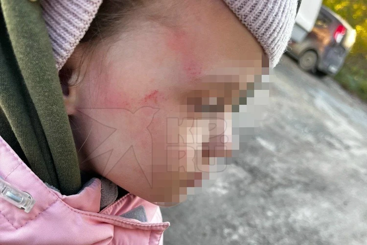 Вдавила ребенка в плитку: на Урале воспитательницу подозревают в избиении 5-летней девочки