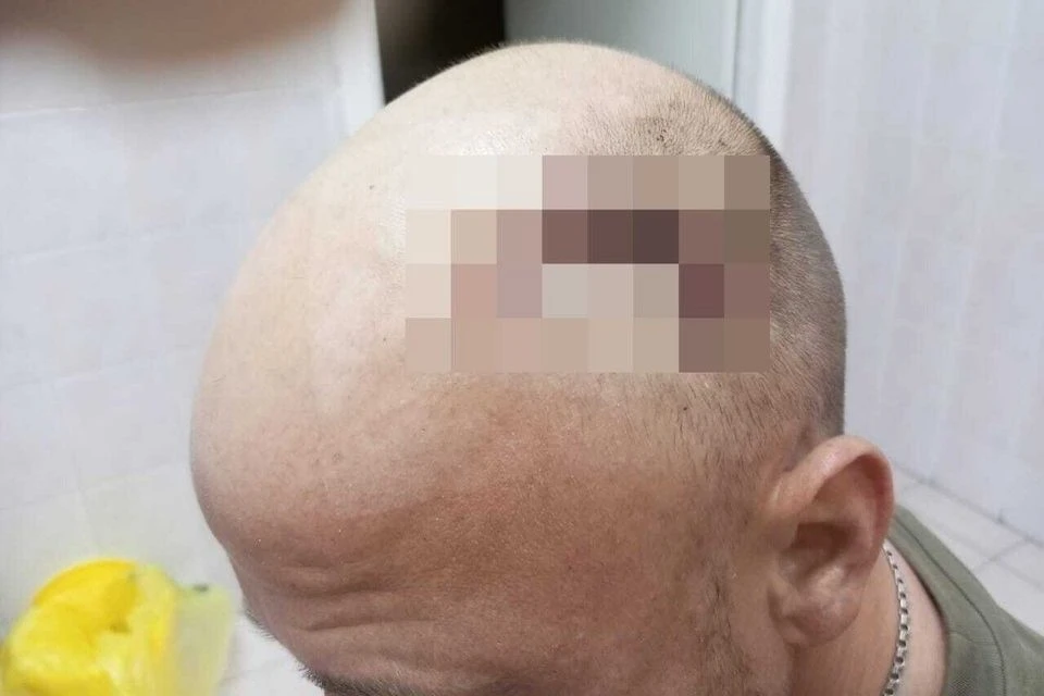 Под Новосибирском мужчине проломили череп. Фото: предоставлено пострадавшим.