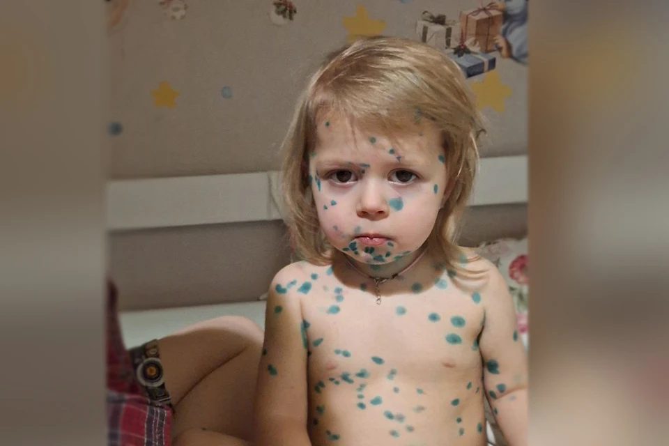 Единственная профилактика от ветряной оспы - это вакцинация. Фото: Мария Сергеева.