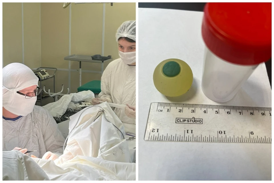 Похоже глаз школьник проглотил по ошибке. Фото: пресс-служба Минздрава Челябинской области.