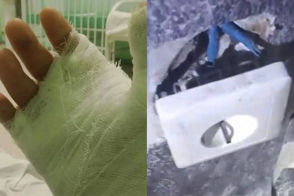 Мальчик оказался в реанимации после удара током от батареи. Фото: предоставлено Полиной/предоставлено УК.