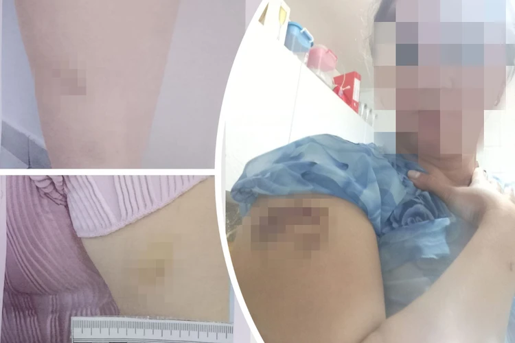 «Я подала на развод, а он кричал, что любит, и бил»: в Новосибирске многодетная мать обвинила мужа в избиении