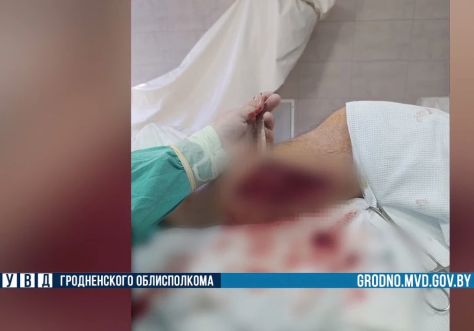Медики оказывают раненному мужчине всю необходимую помощь. Фото: УВД Гродненского облисполкома.