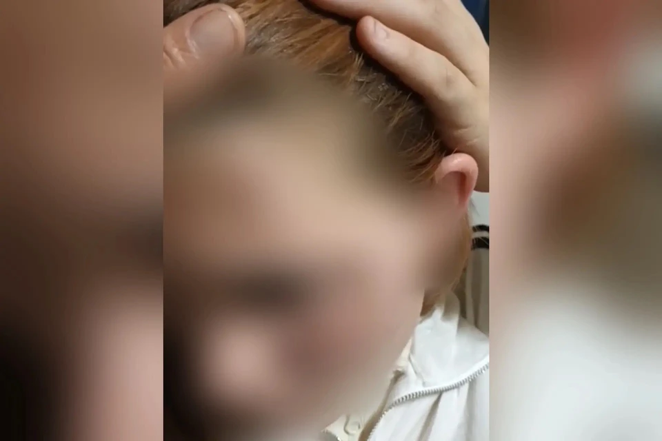 Девочка прибежала избитая домой. Фото: предоставлено мамой пострадавшей
