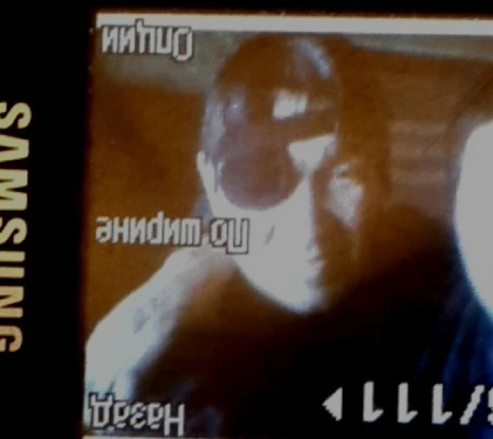 Владимиру Шулбаеву в 2006-м медведица в тайге сняла скальп, он выжил благодаря силе духа и помощи людей. Фото - архив Сергея Шулбаева.