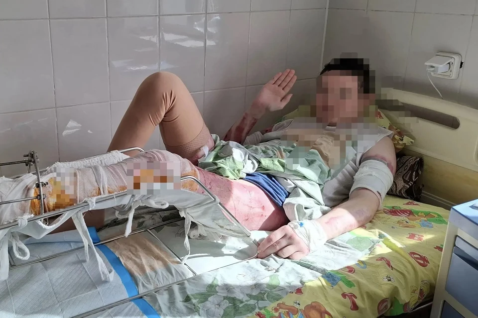 Несмотря на тяжесть состояния пациента и предполагаемые прогнозы, мы решили бороться. Фото: группа ВК ГАУЗ "ДРКБ" МЗ РБ.