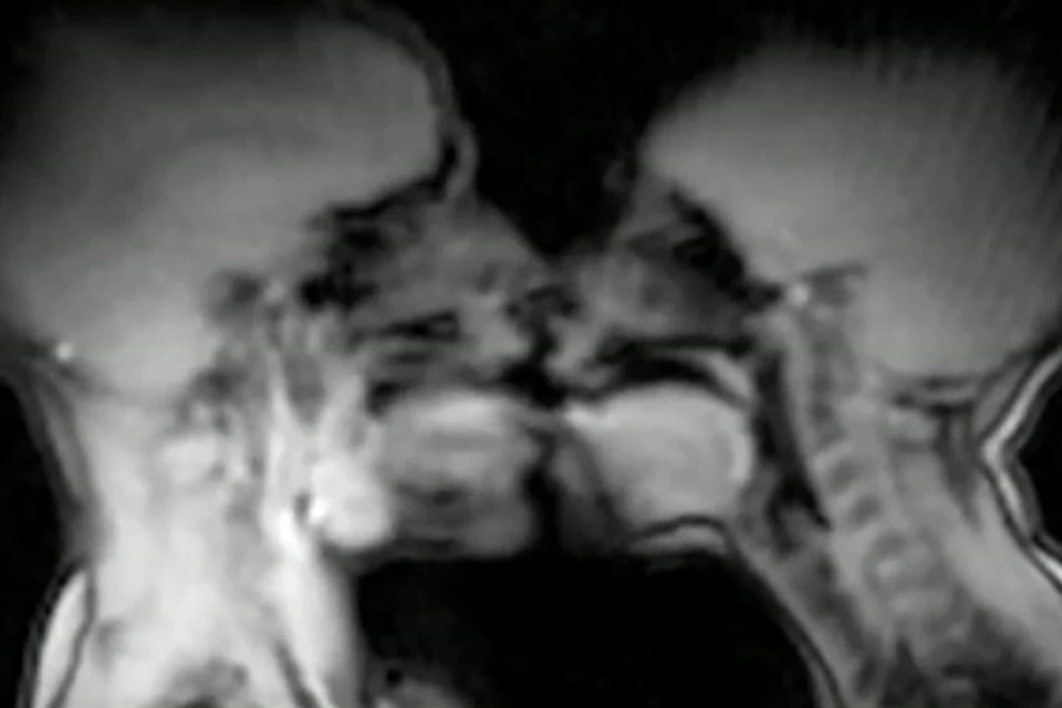 В интернете появилось видео, на котором запечатлены поцелуи и секс в аппарате МРТ