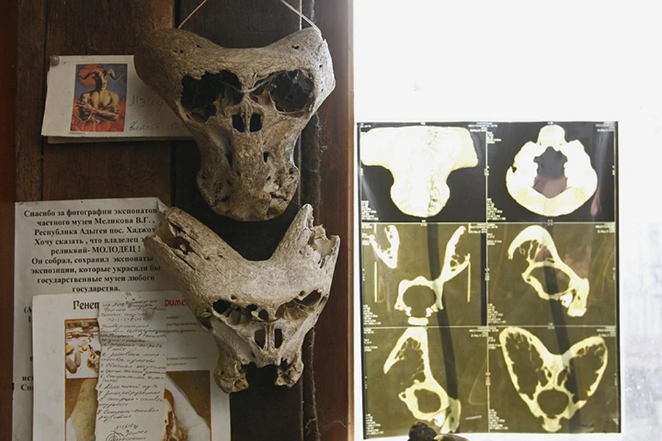 У черепов отсутствуют элементы, которые должны быть в нормальных останках. Фото: Владимир Аносов\Российская газета