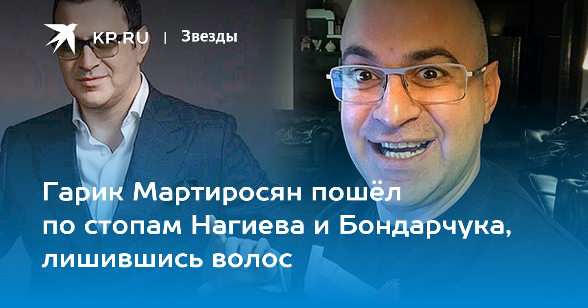 Гарик мартиросян пересадил волосы фото Они нашли себя ЯПлакалъ